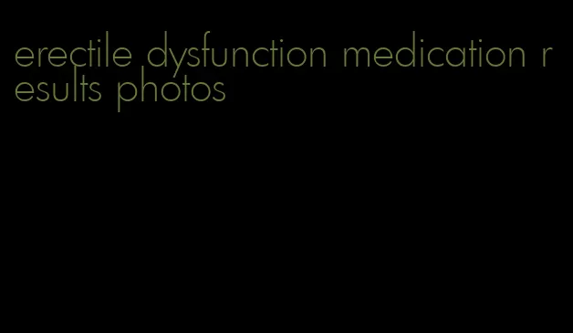 erectile dysfunction medication results photos